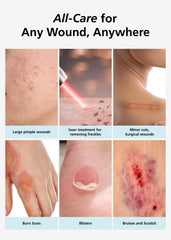 Latex-free hydrocolloid dressing minimizes irritation for sensitive skin.
