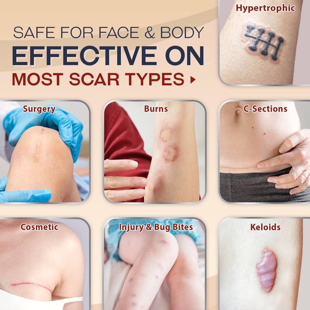 Ebanel scar gel used on face and body for smooth texture