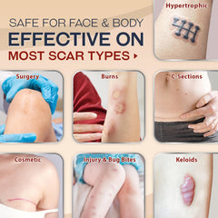 Ebanel scar gel used on face and body for smooth texture