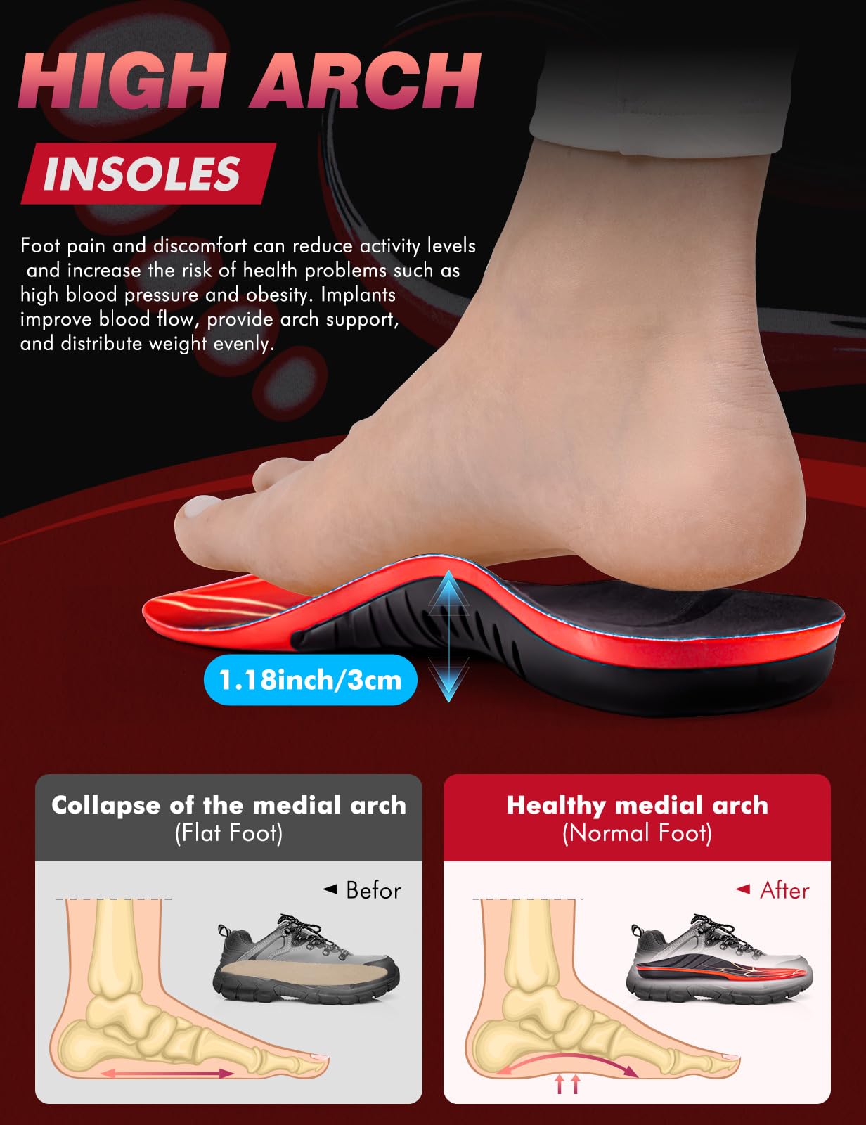 EIRMAT arch-support insoles side profile highlighting rigid arch and cushioning.