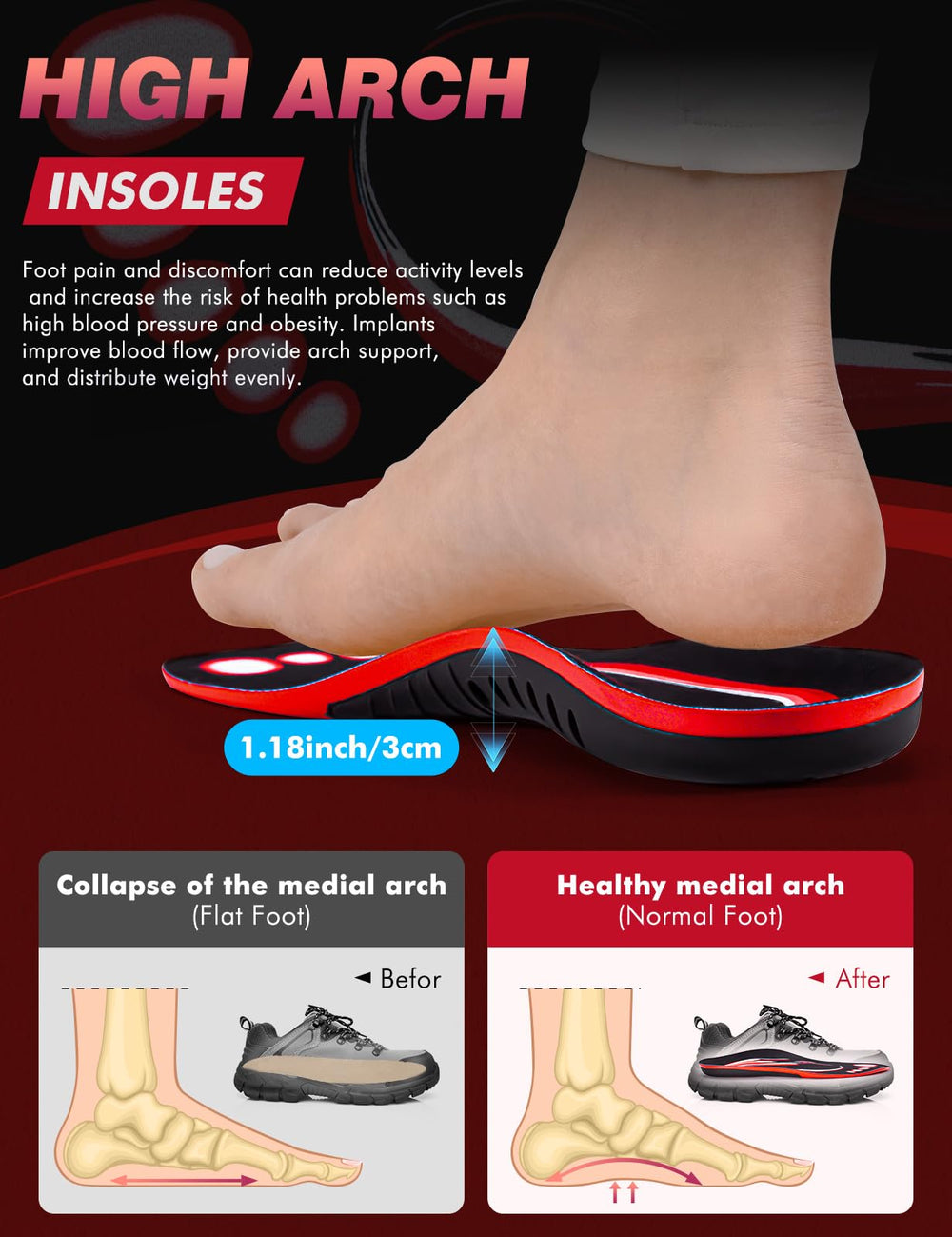 EIRMAT trim-to-fit insole shows cut lines for personalized comfort.