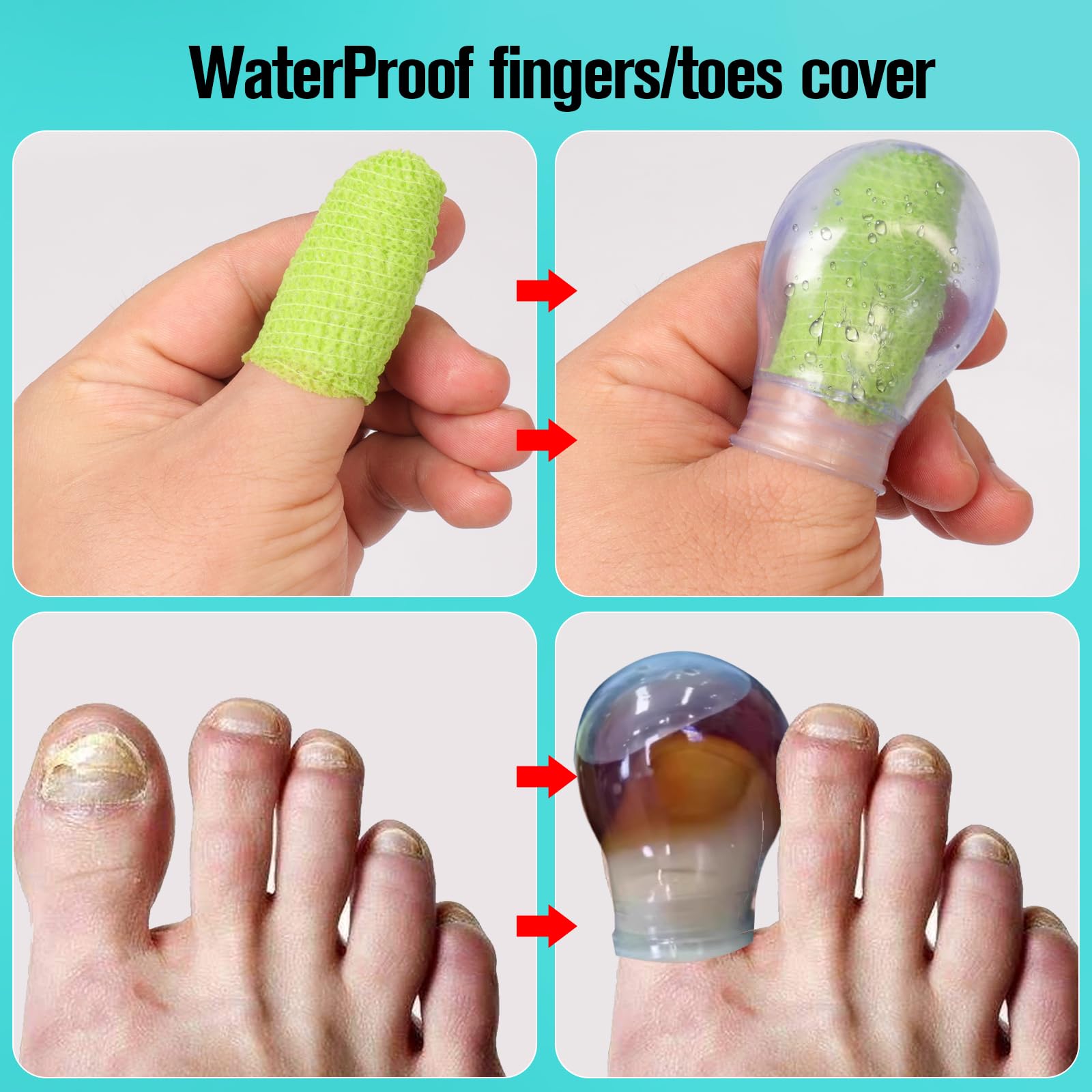 Eldosilk waterproof finger sleeve protects during washes and manicures.