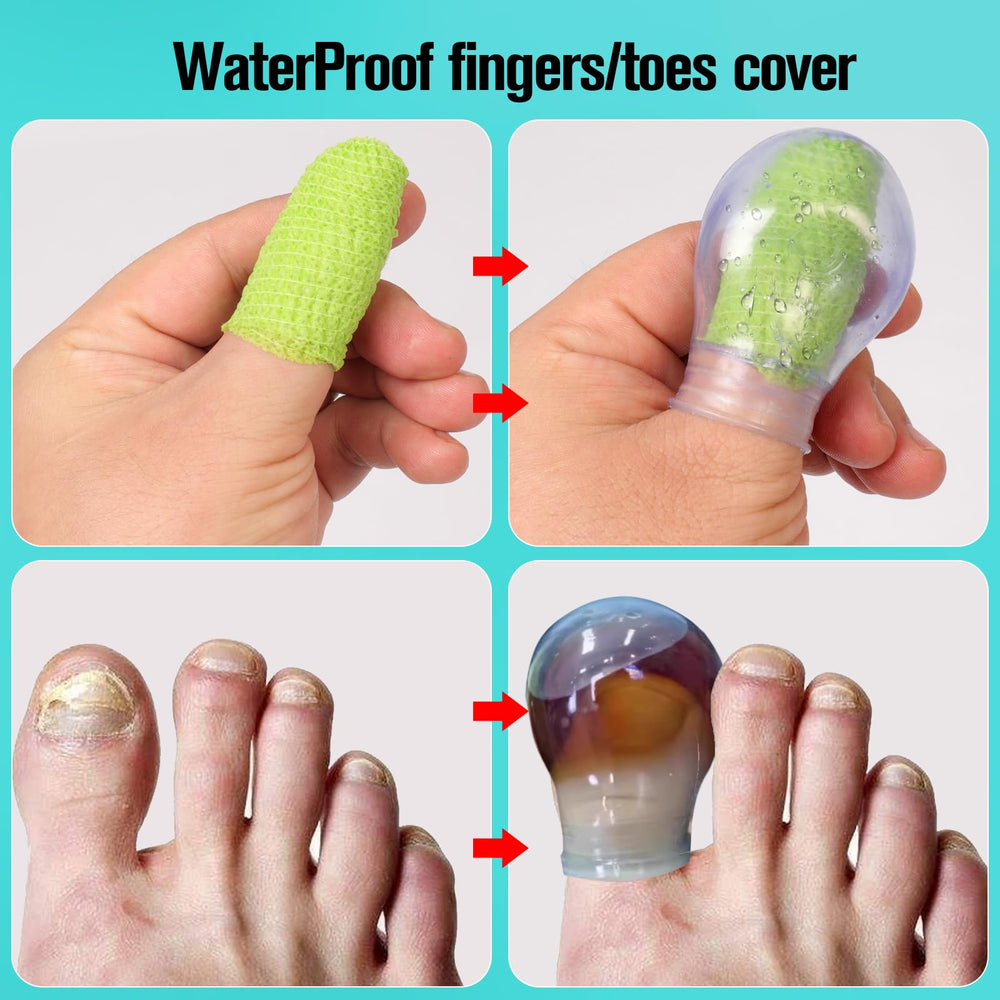 Eldosilk waterproof finger sleeve protects during washes and manicures.