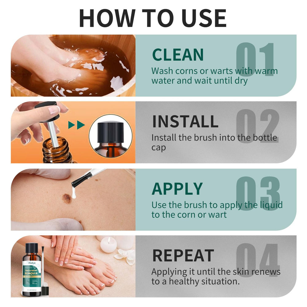 ELEFOCUS Wart Remover Liquid targets troublesome areas on feet for confident care.