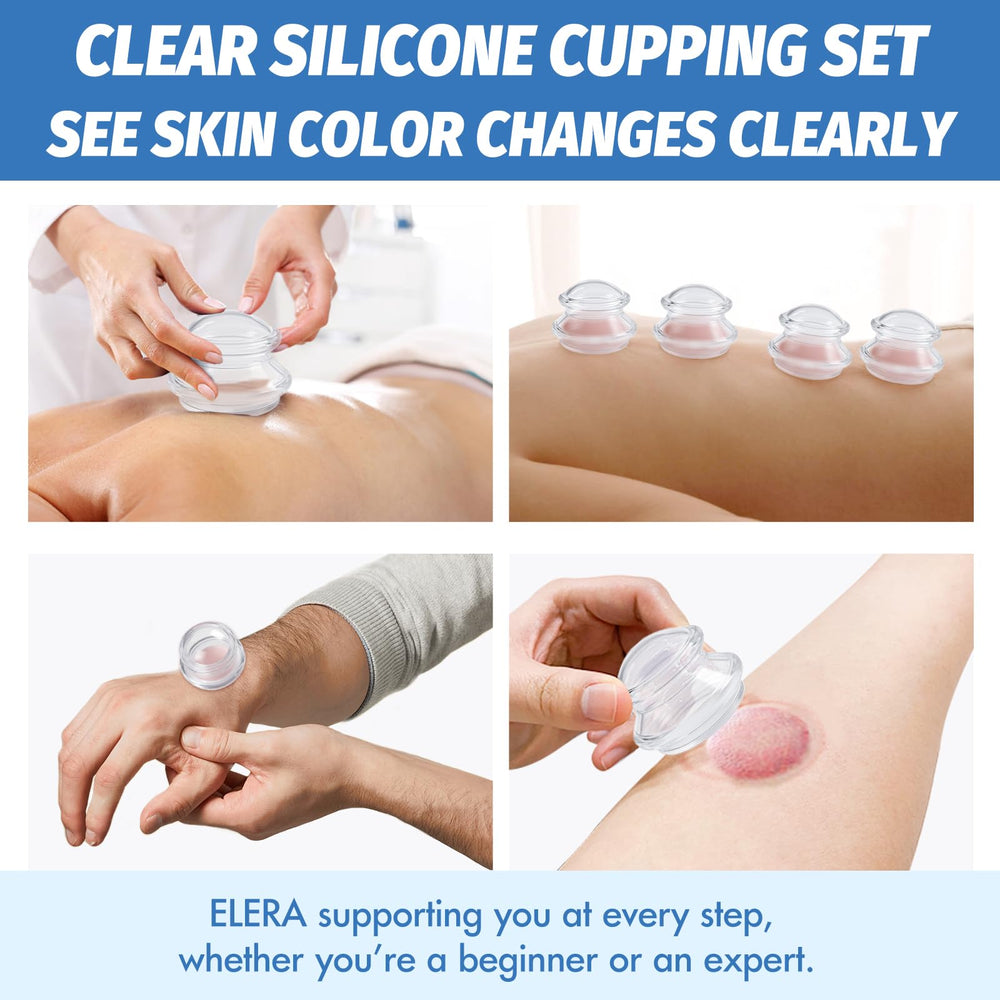 ELERA cupping oil-ready use facilitates smooth gliding and effective suction.