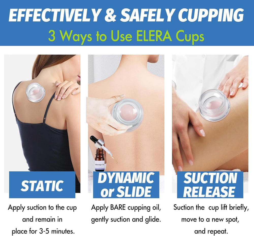 ELERA cupping set close-up emphasizes safe, clear silicone for skin-friendly sessions.