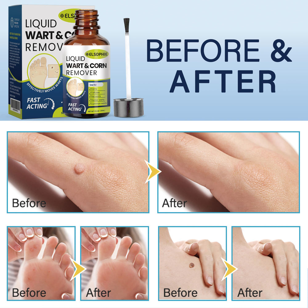 Elsophie easy-application precision reduces mess during use