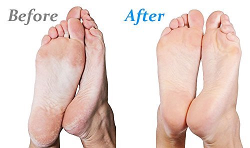 Ergonomic handle of Emjoi Micro-Pedi 3D Power for comfortable use