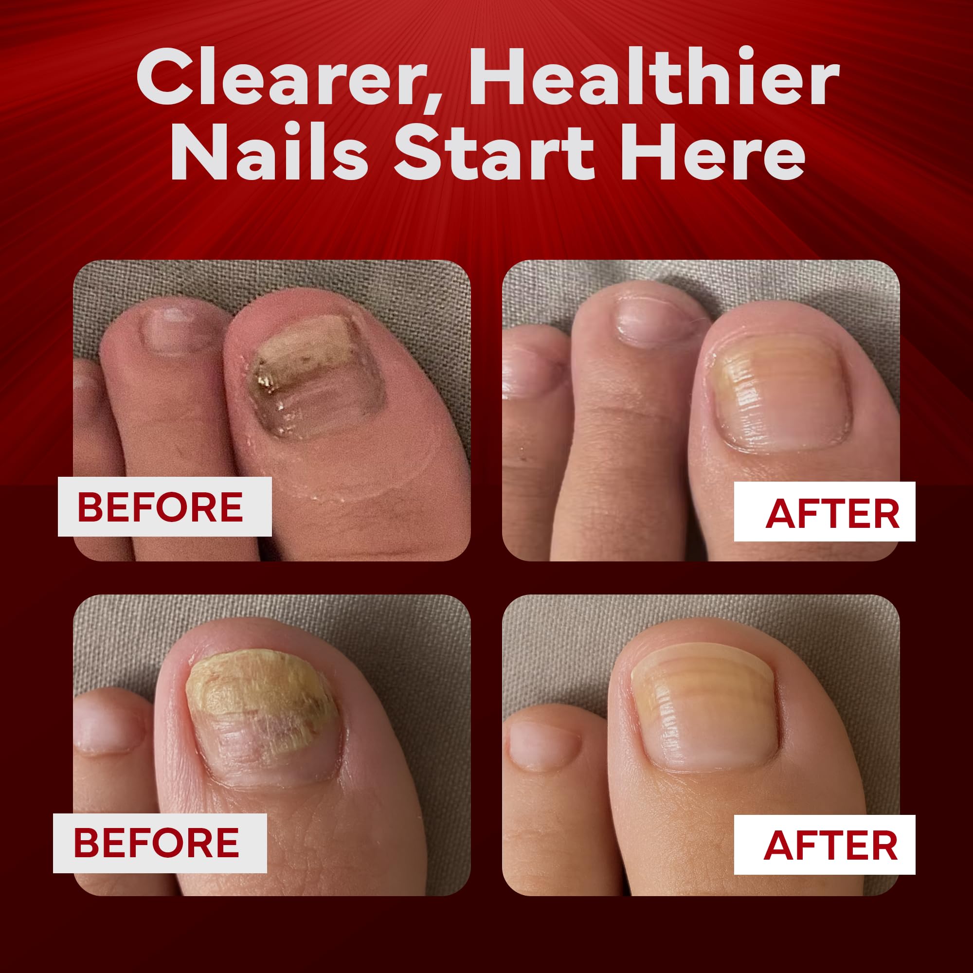 emuaidmax vitamin E ingredient closeup for nail and skin support