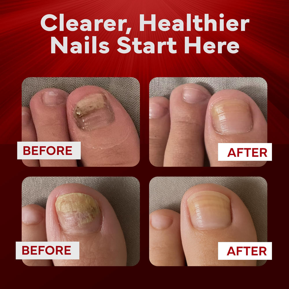 emuaidmax vitamin E ingredient closeup for nail and skin support