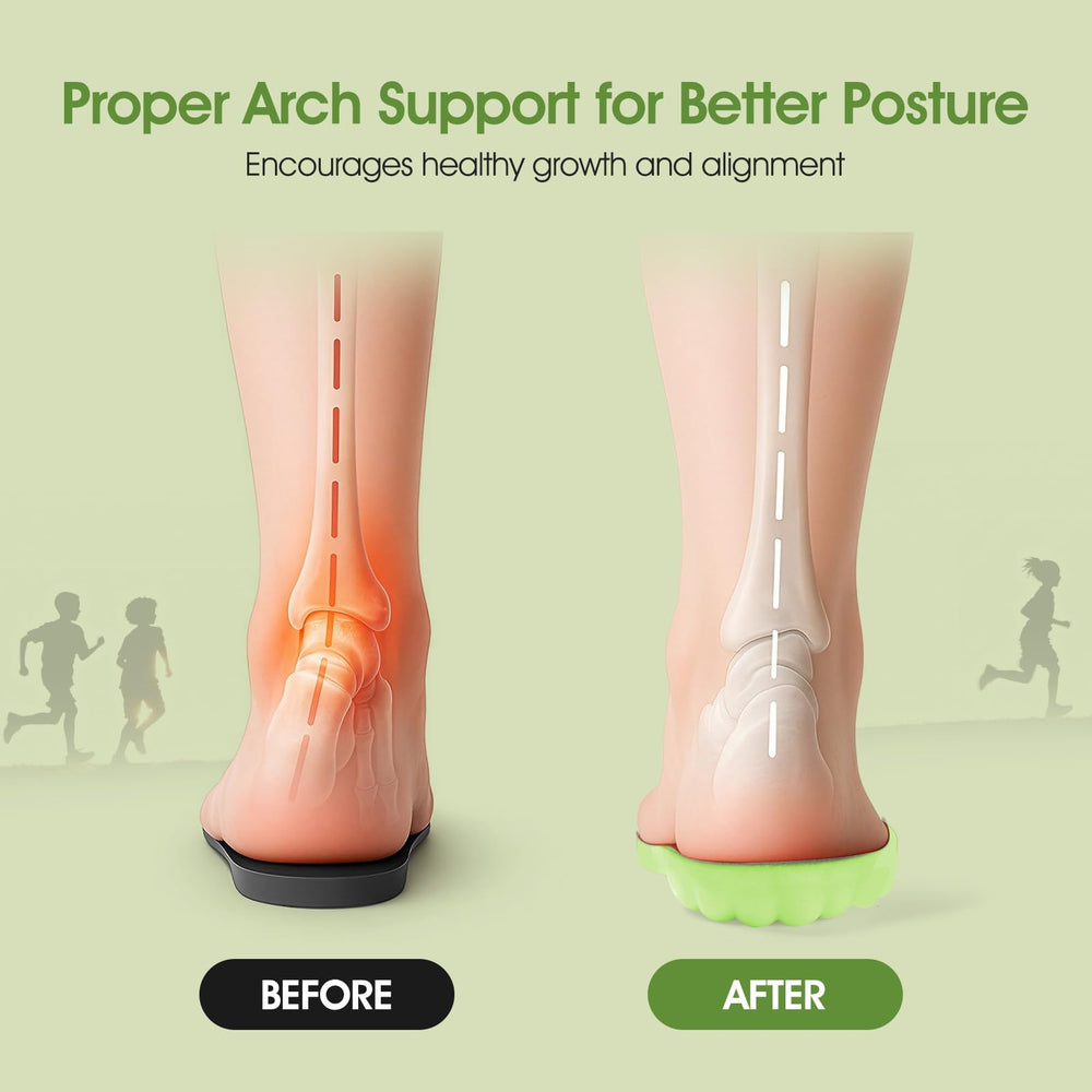 ENLOPQ U-Heel Shock Protection insoles absorb impact for jumping and running with less joint strain.