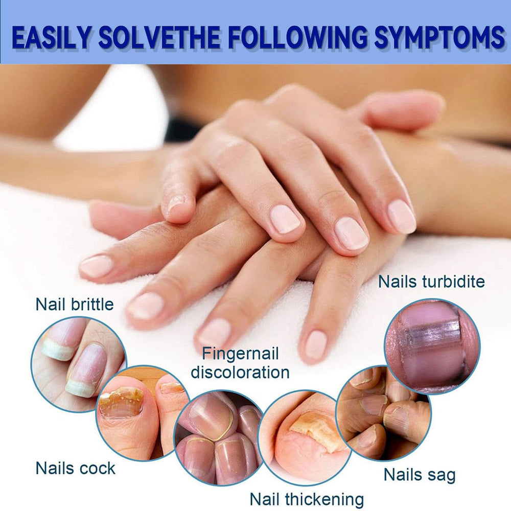 Eqimznv nail discoloration improvement patch enhances nail look and texture