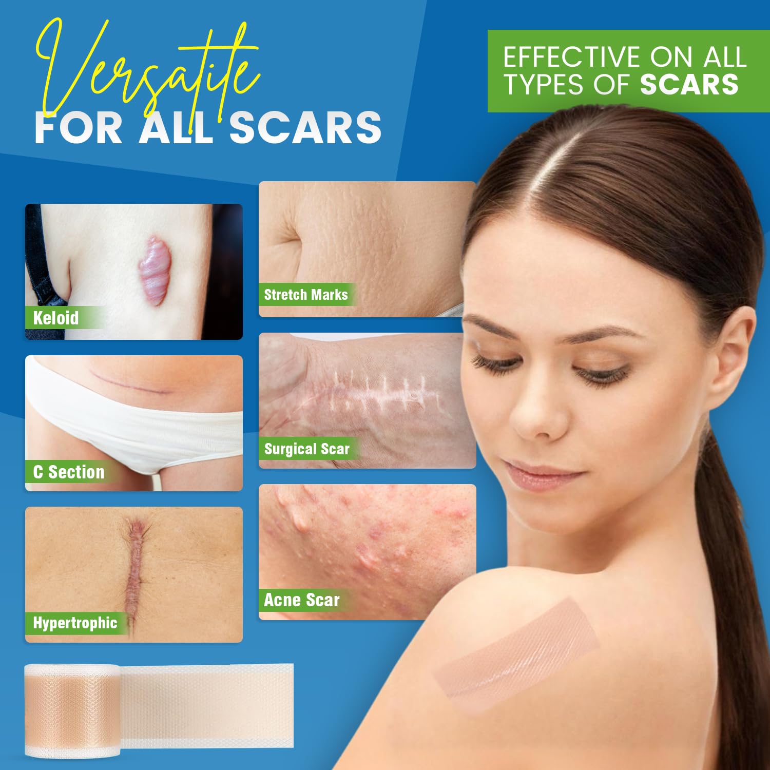 EQUIPNEST scar tape applied on skin demonstrates gentle adhesion.