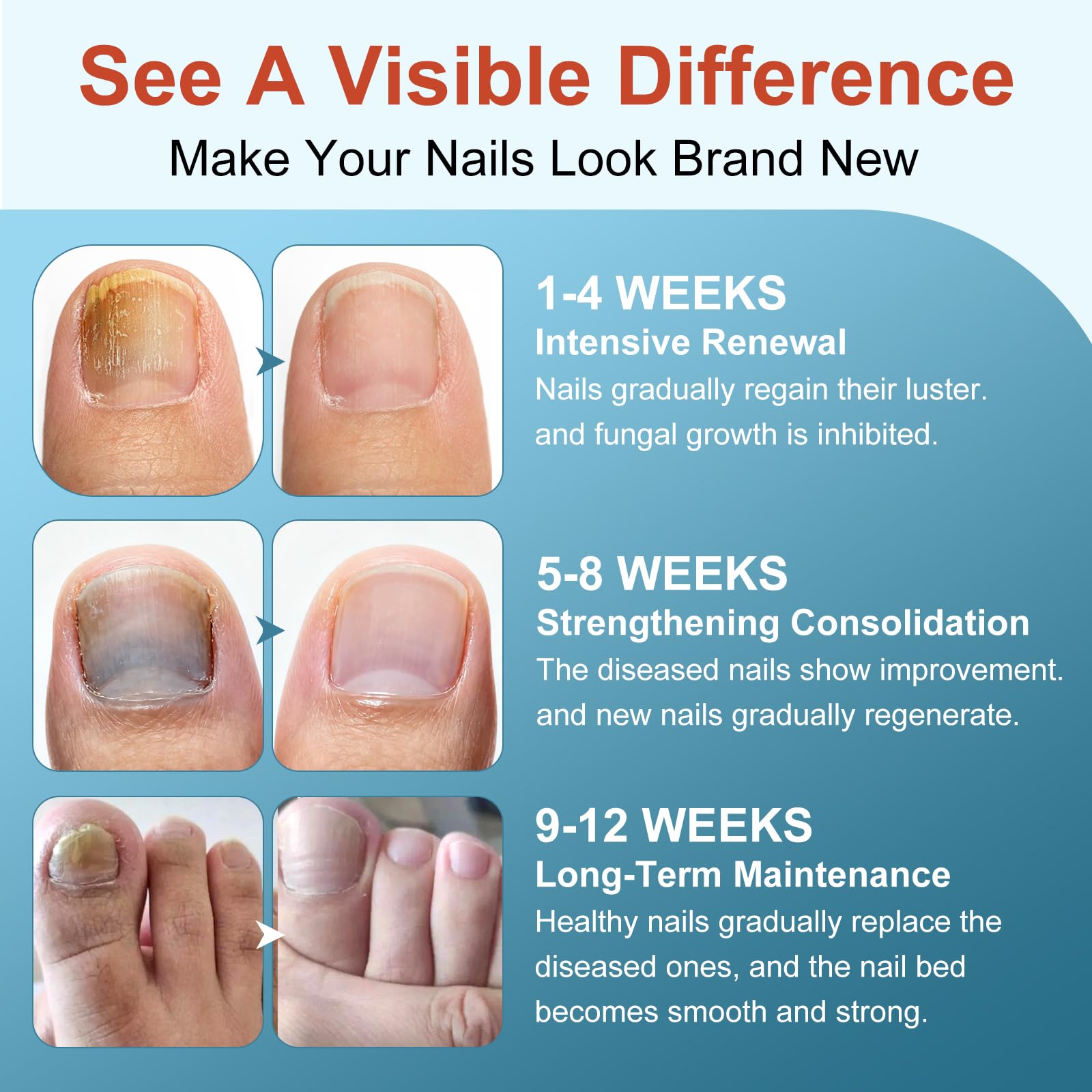 No bandage needed; direct application keeps nails clean during use.
