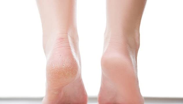 Refill pack image emphasizes ongoing foot care with Ever Ready
