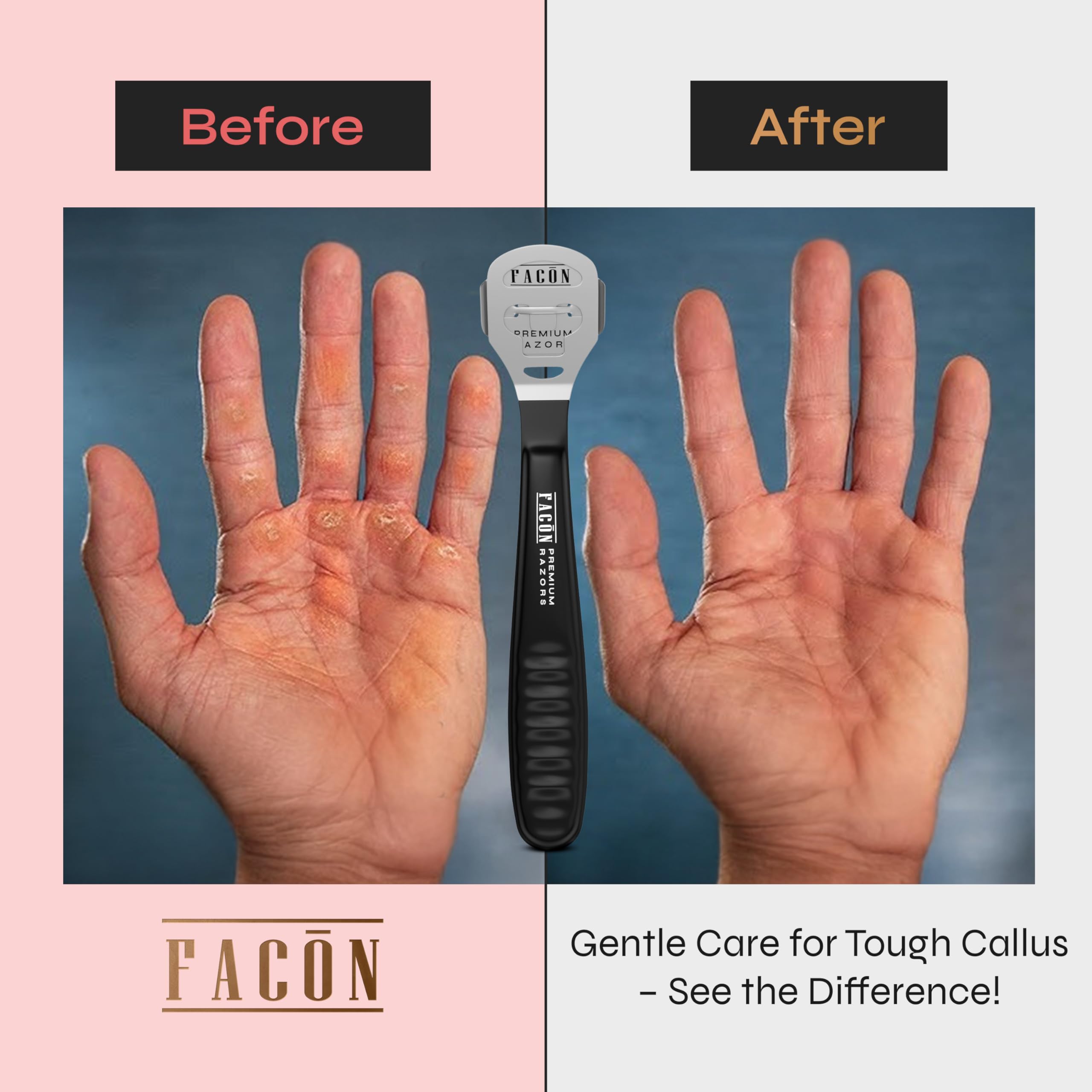 FACON sistema de cambio de hojas para uso continuo