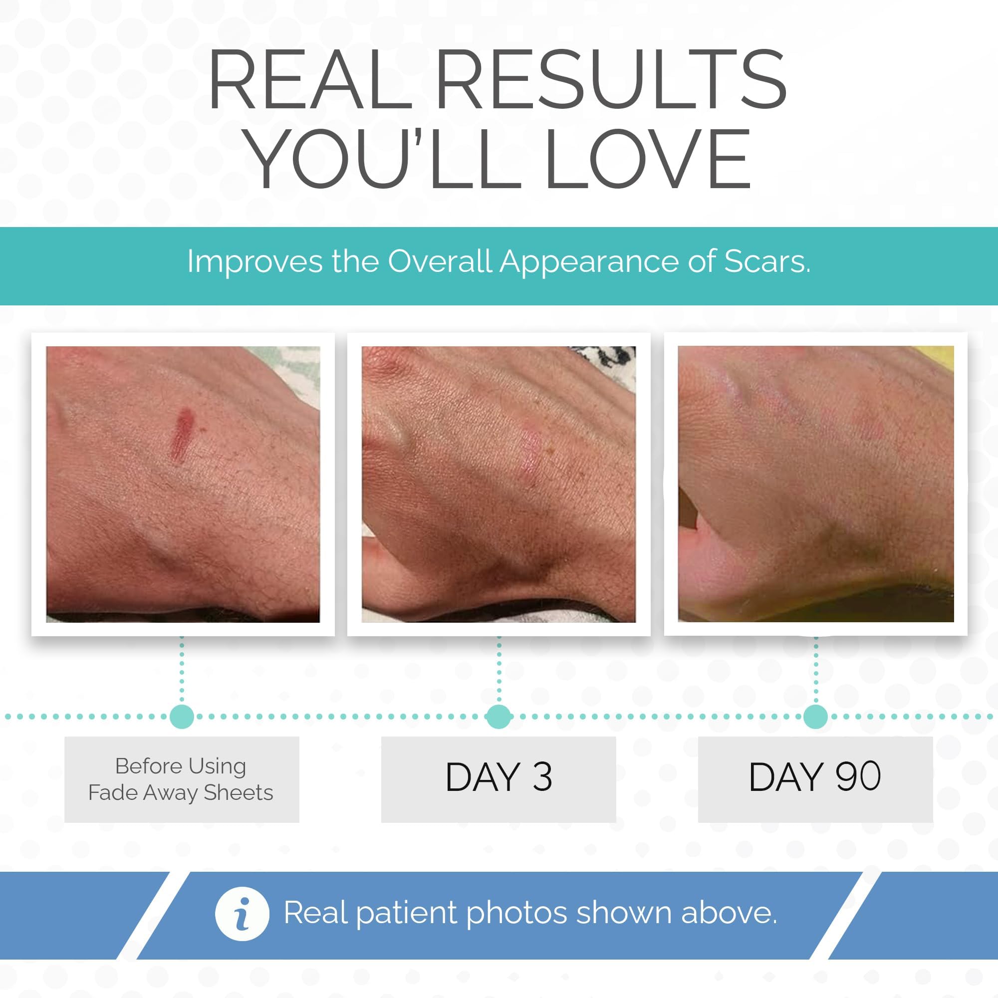 Fade Away scar sheets breathable material conforms to skin.
