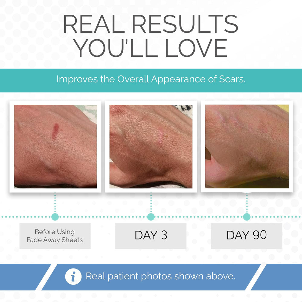 Fade Away scar sheets breathable material conforms to skin.
