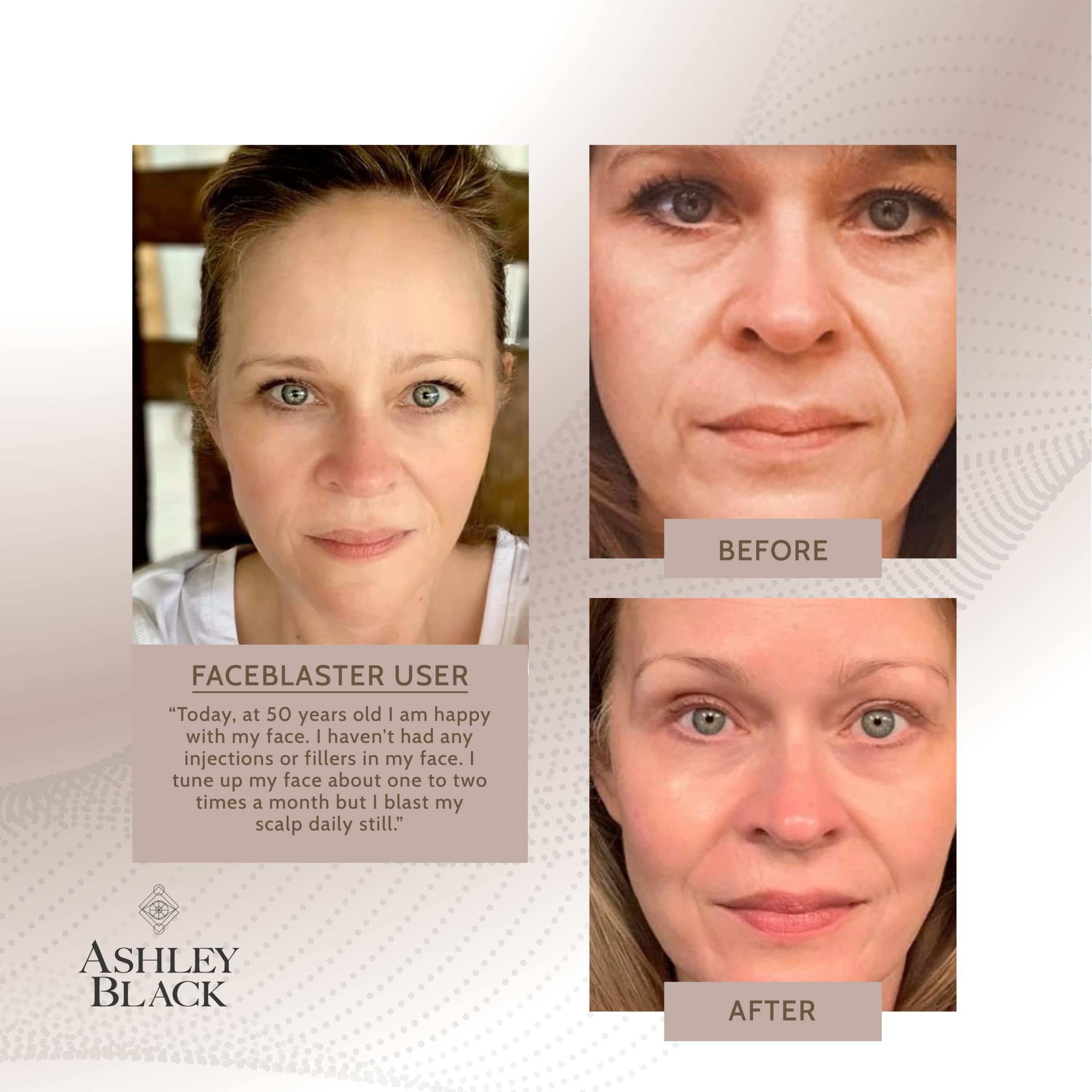 FasciaBlaster FaceBlaster light massage motion supports collagen matrix activation