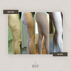 FasciaBlaster Mini 2 massage on feet to relax tired muscles