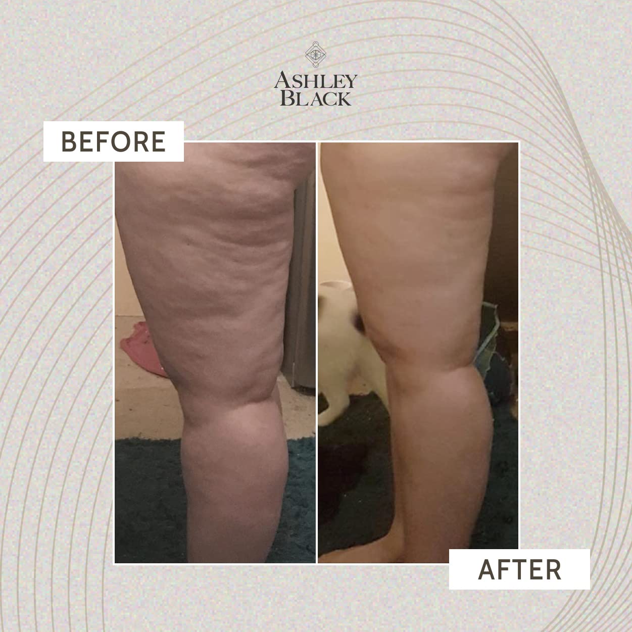 The Nugget targets deep trigger points for focused release.