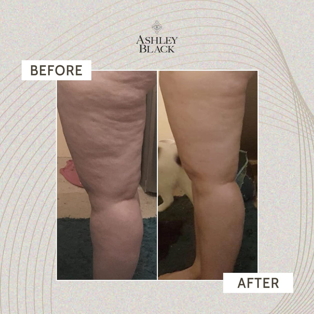 The Nugget targets deep trigger points for focused release.