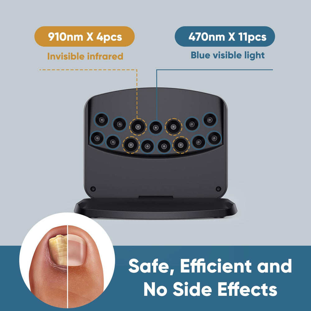 FEIGOMA Nail Fungus Light Device back view with switch