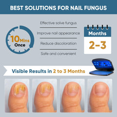 FEIGOMA device used on foot for at-home care