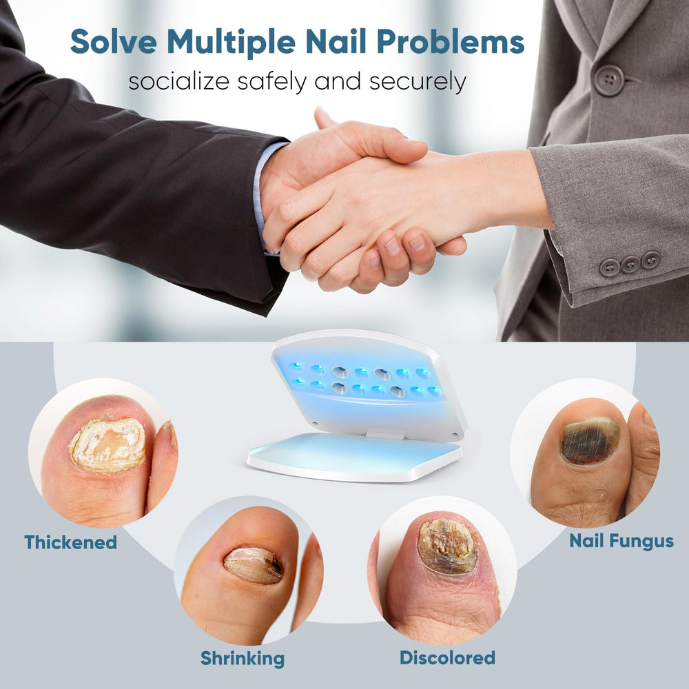 FEIGOMA nail fungus light device in use with foot insertion for safe treatment