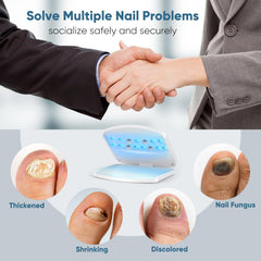 FEIGOMA nail fungus light device in use with foot insertion for safe treatment