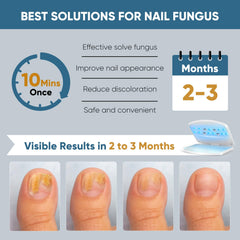 FEIGOMA nail fungus light device top panel with time settings for convenient sessions