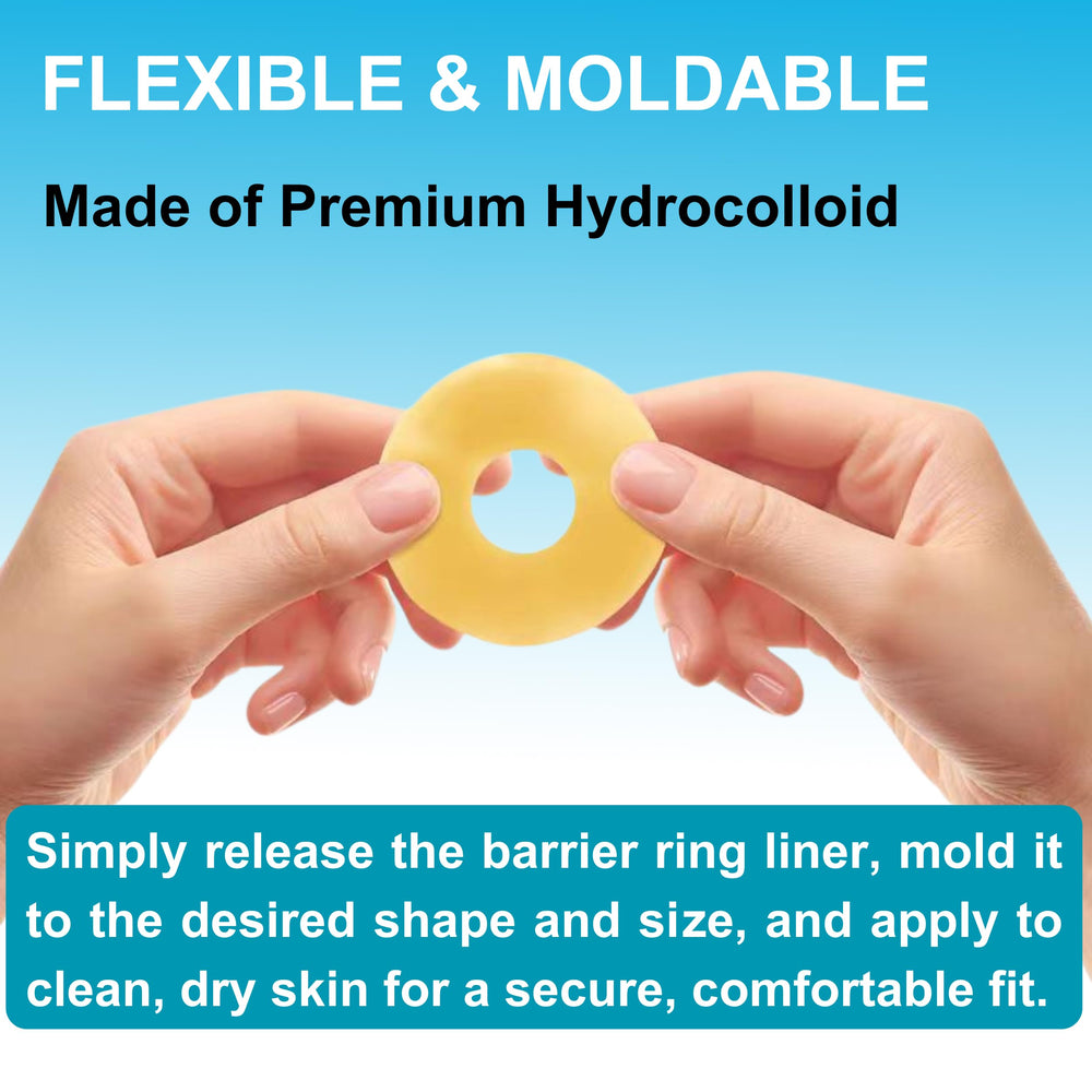 Filigan moldable design ring adapts to stoma shapes for a customized seal.