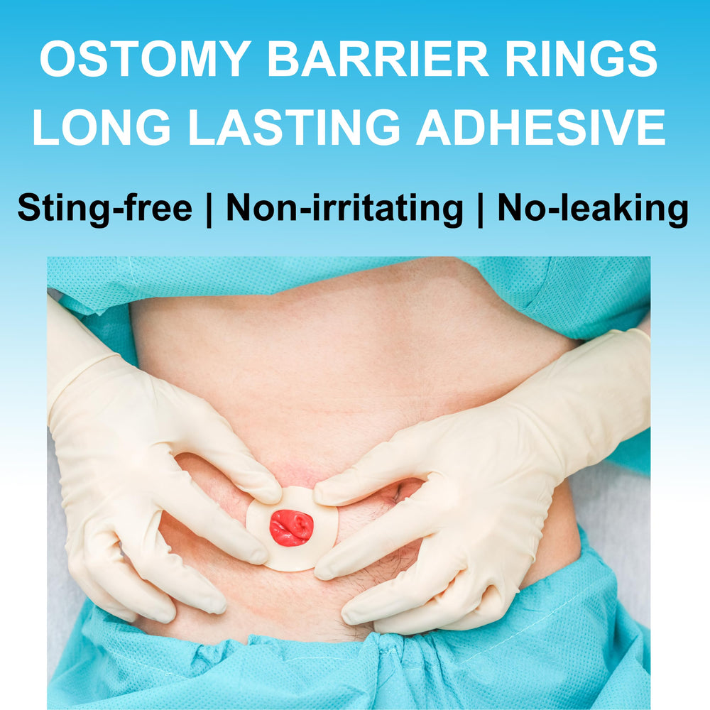 Filigan barrier ring may support stable adhesion to reduce leakage around the pouch.
