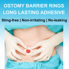 Filigan barrier ring may support stable adhesion to reduce leakage around the pouch.