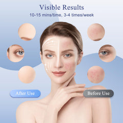 Fiogeo LED mask purple light for mood-enhancing sessions.