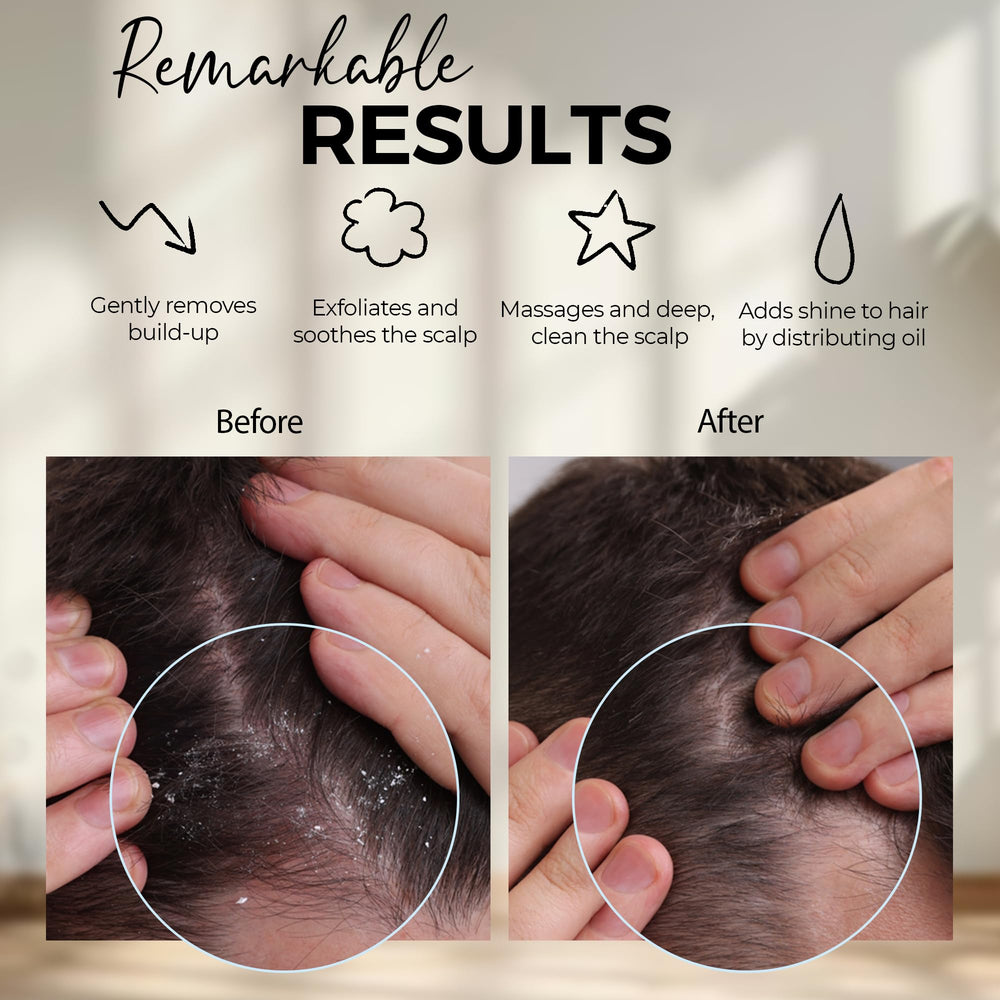 Cerdas de silicona Fiora Naturals suaves para limpieza sin tirar del cabello.