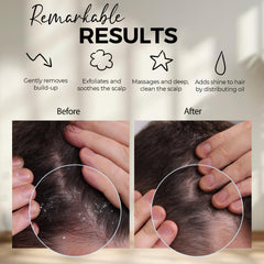 Cerdas de silicona Fiora Naturals suaves para limpieza sin tirar del cabello.