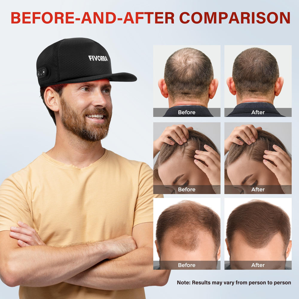 FIVORRA cap delivers gentle heat for warm, comforting irradiation.