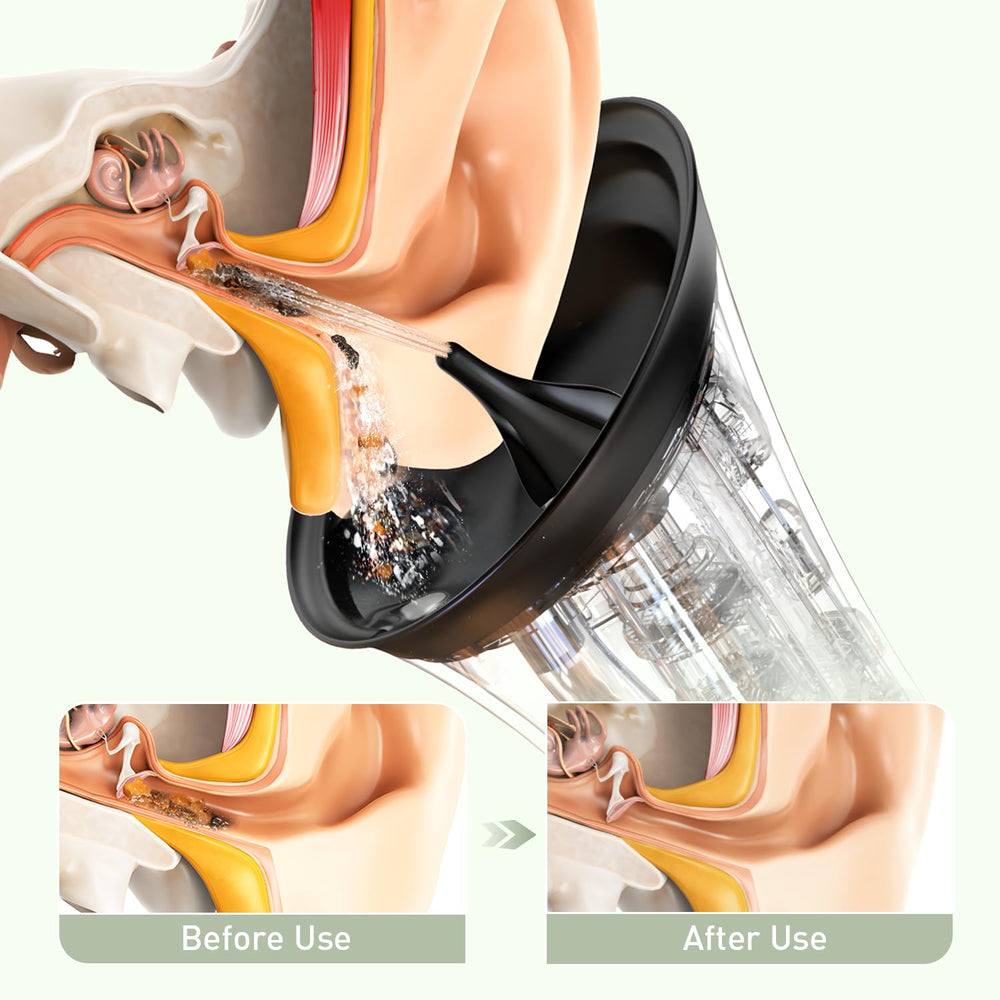 FlaoAito Ear Cleaner side profile highlighting ergonomic grip for comfortable handling