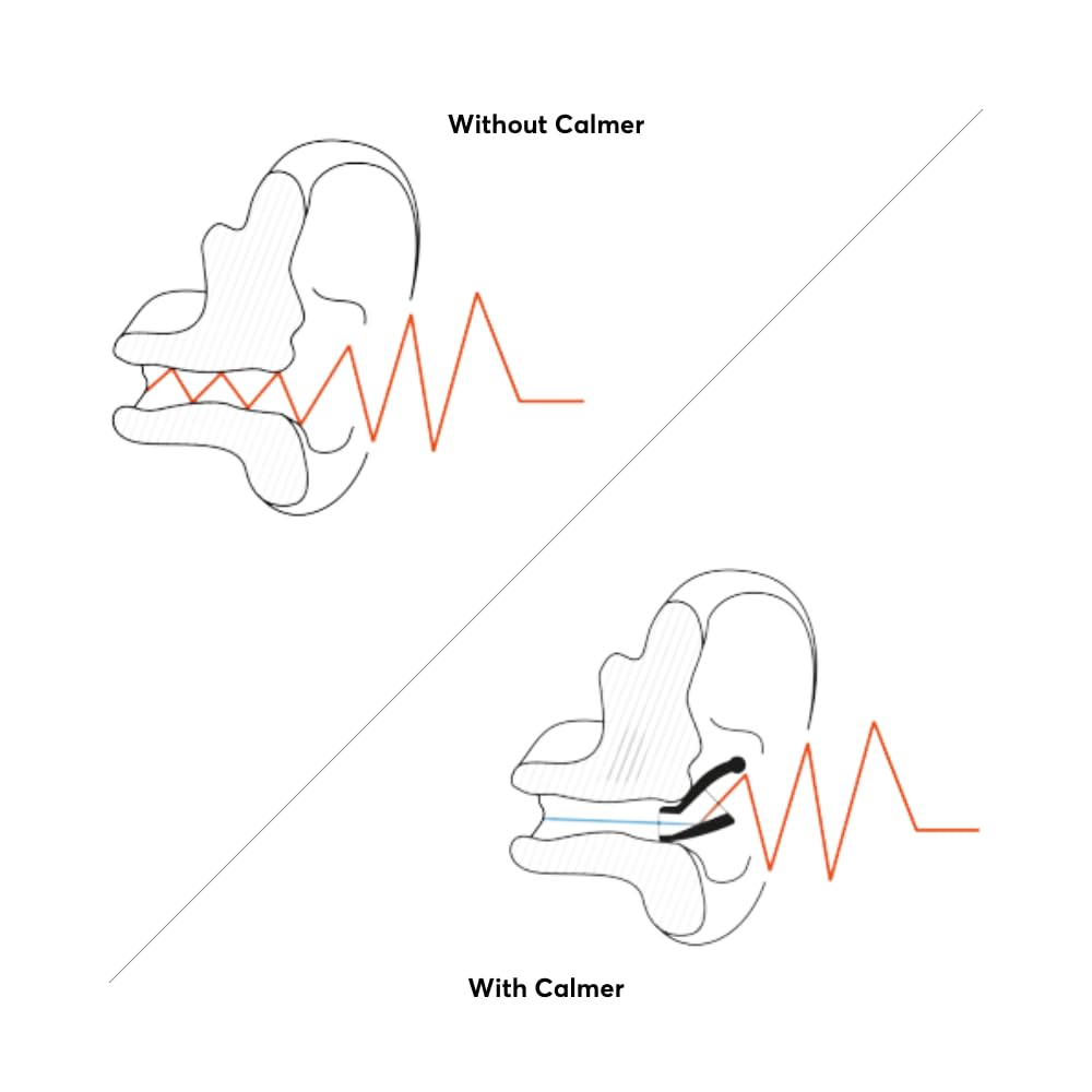 FLARE AUDIO Calmer comes with carry pouch and recyclable packaging for daily use.