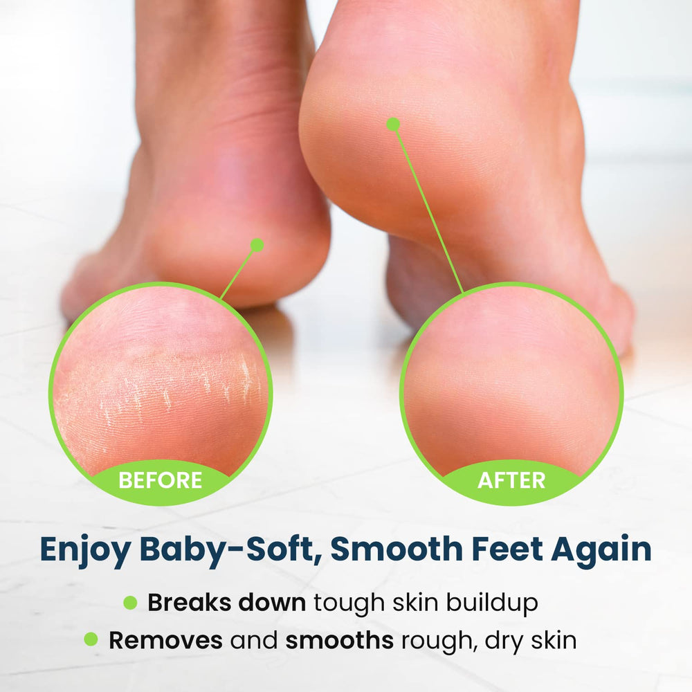 Foot Cure discolored toenail solution improves appearance with natural ingredients.