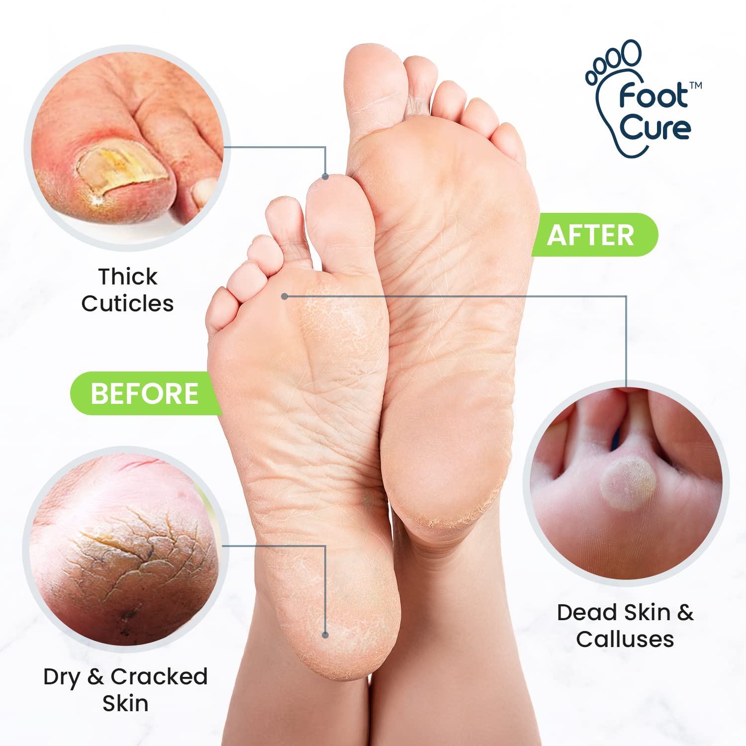 Foot Cure electric foot bath massager basin enables relaxing foot care at home.