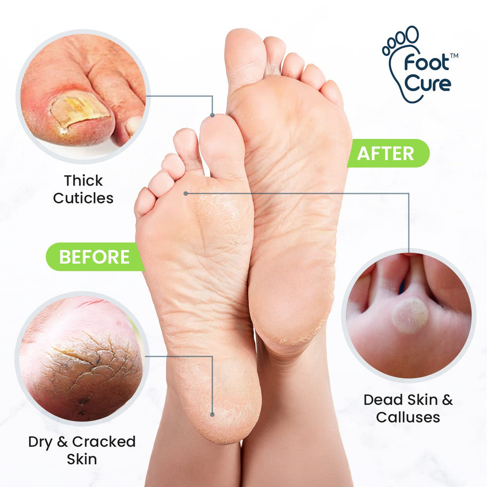 Foot Cure electric foot bath massager basin enables relaxing foot care at home.