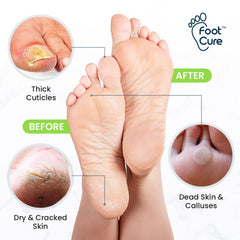 Foot Cure electric foot bath massager basin enables relaxing foot care at home.