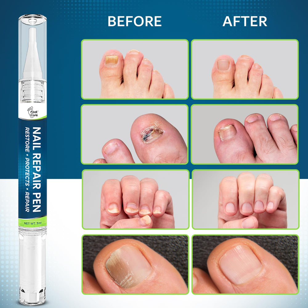Foot Cure Tea Tree Oil bottle highlighting natural care ingredients