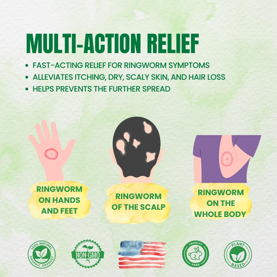 Forces of Nature Ringworm application area demonstrates quick-absorbing relief on affected skin.