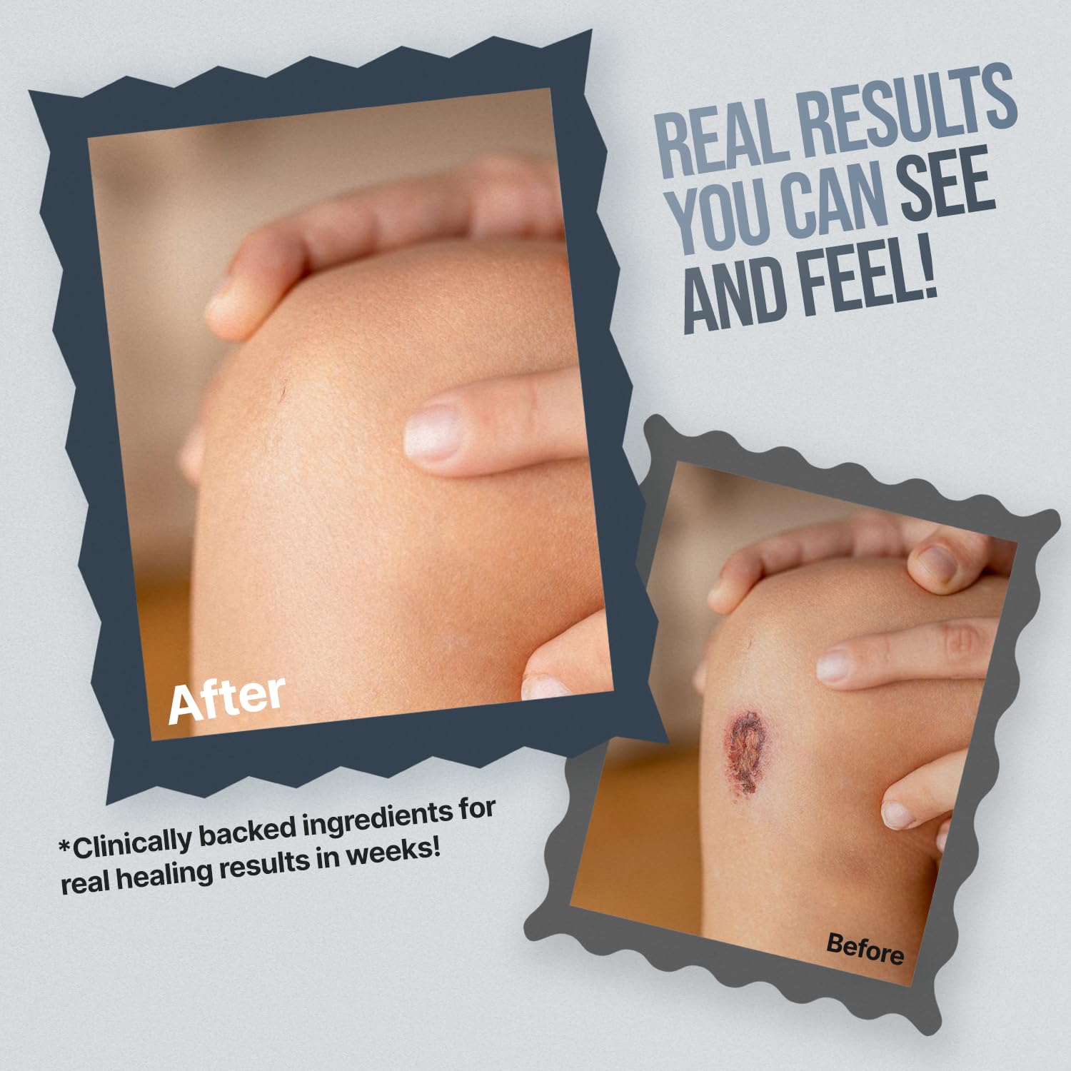 Free Life Labs WoundWorx on-shelf shot highlights a trusted recovery aid.
