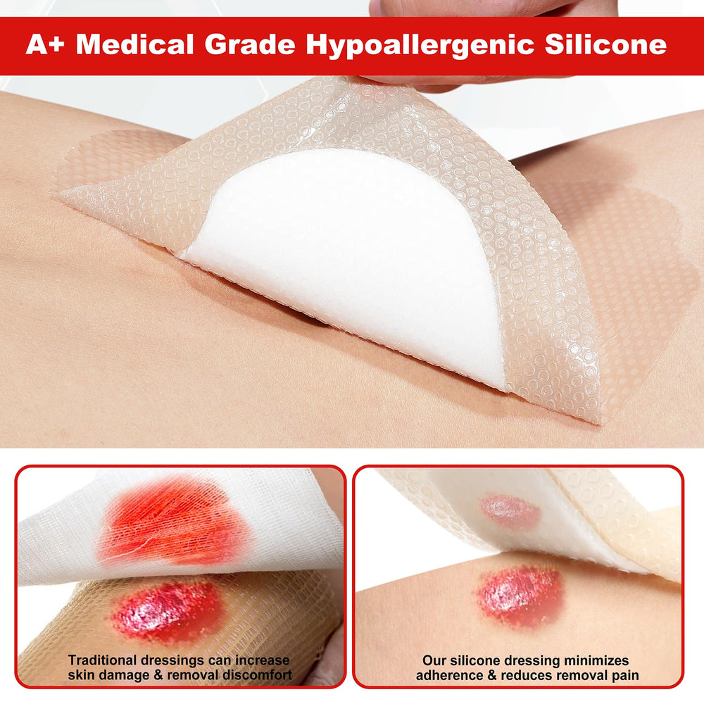 Nonwoven layer disperses exudate for even coverage around sacral wounds.