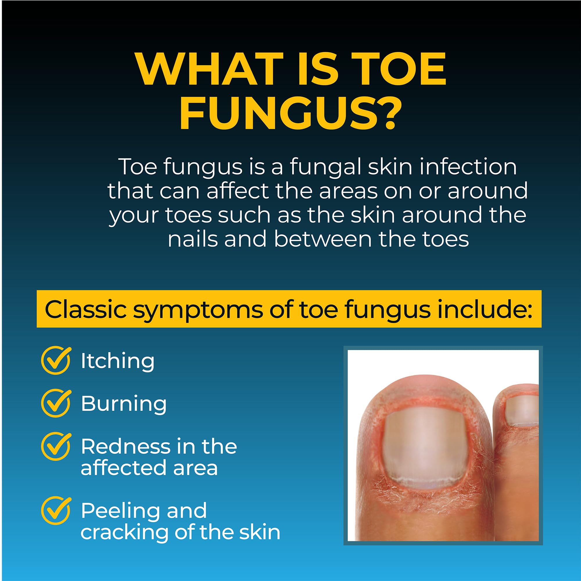 Aloe and tea tree oil components shown in Fungi-Nail formula.