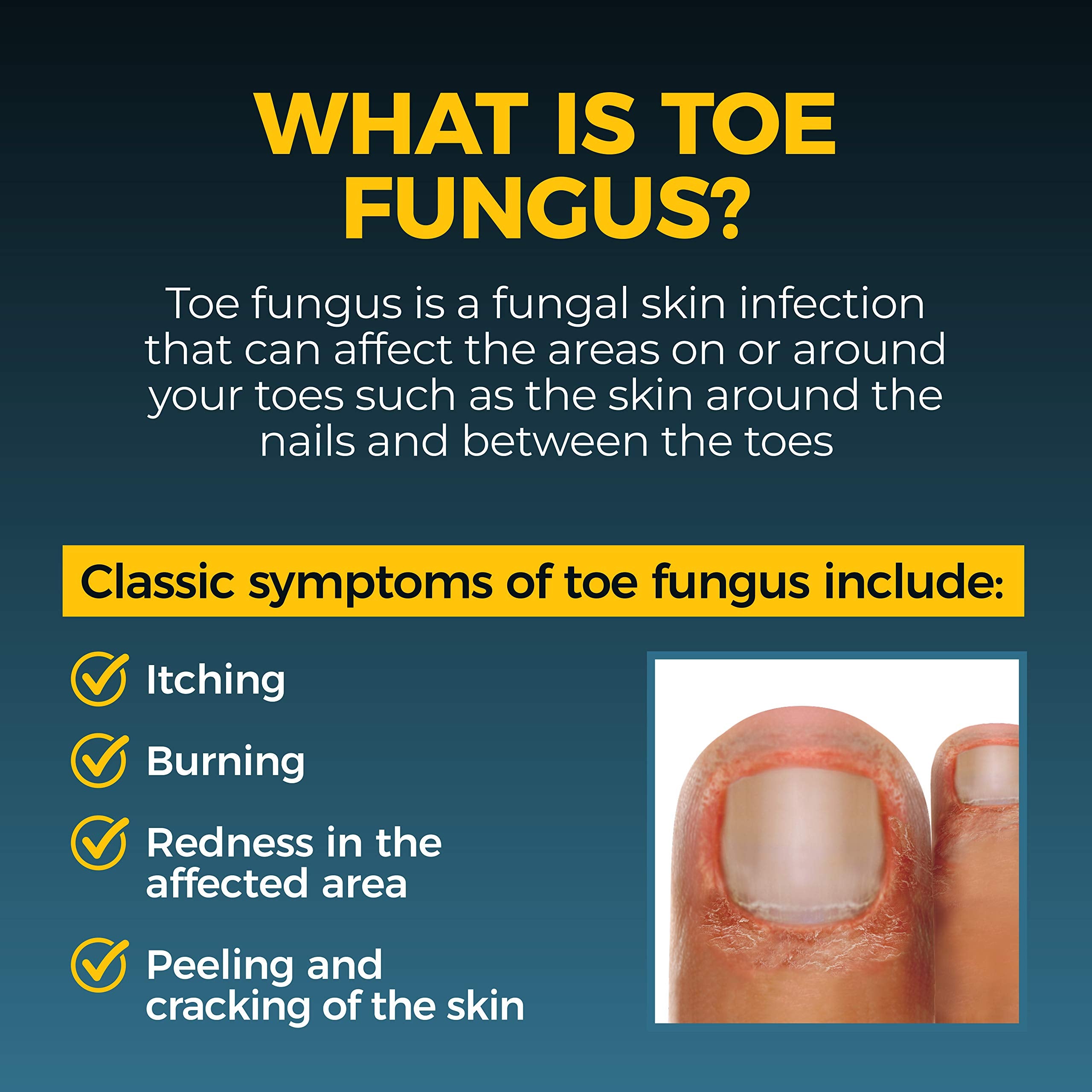 Tolnaftate 1% concentration highlighted on Fungi-Nail bottle label.